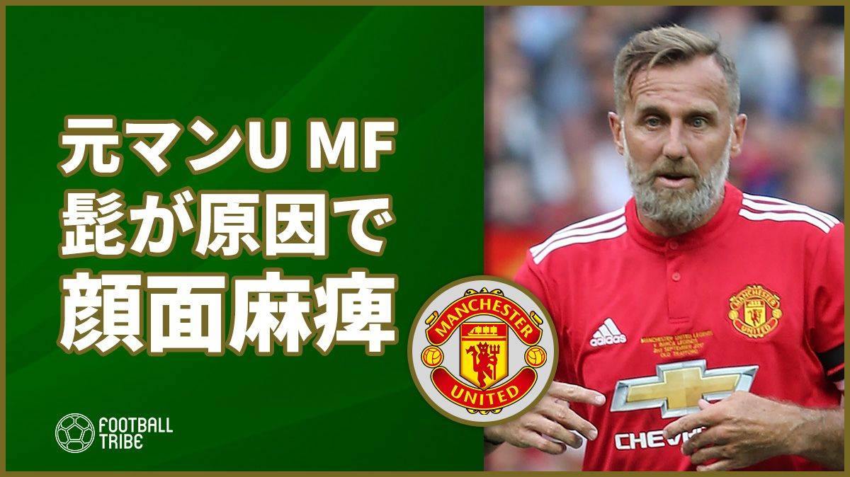 元マンUのMF、一時顔面麻痺に…原因はまさかの「ヒゲ」！？ | Football